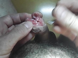 Menindik dan subincision