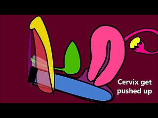 Bagaimana A catch Vagina Mill